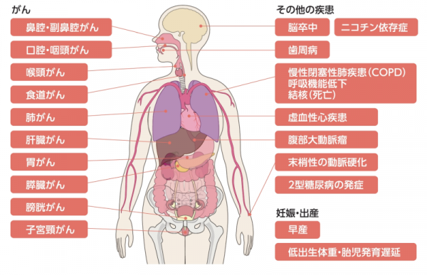 たばこを吸っている本人はこんな病気になりやすくなる